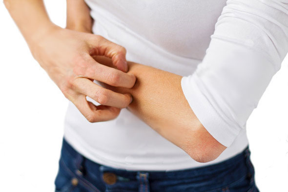 Eczema & Dermatitis