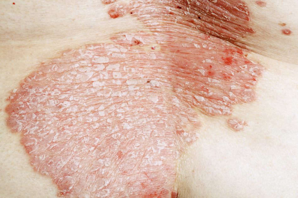 Other Conditions & Treatments