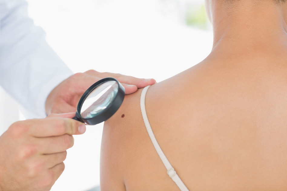 Skin Cancer Diagnosis & Treatment